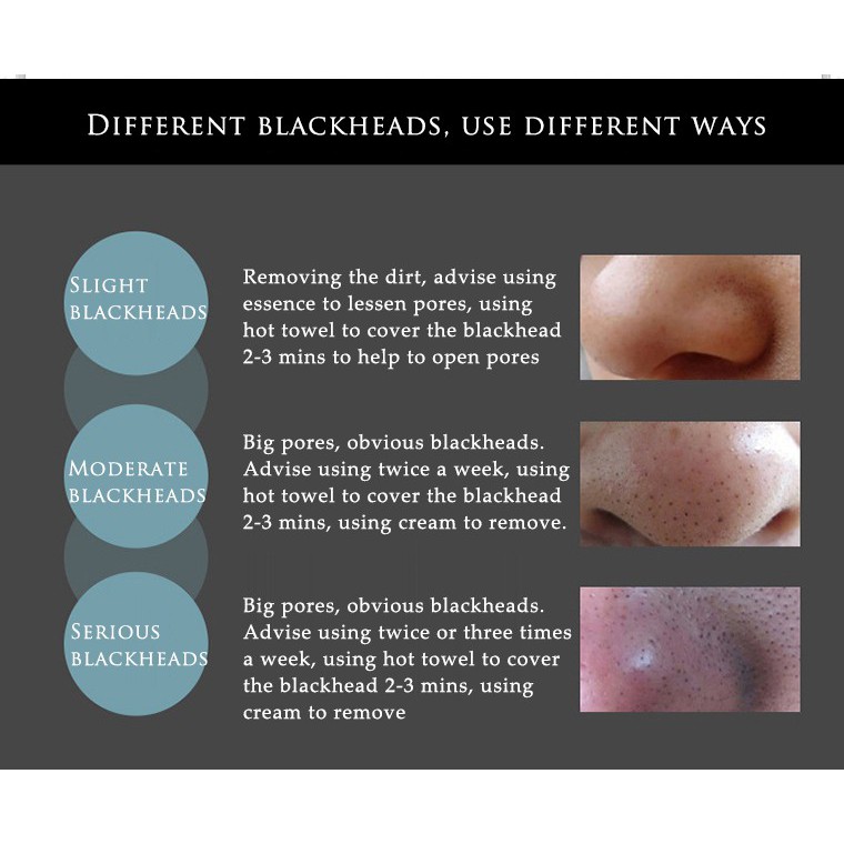 [Ready Stock] BIOAQUA Activated Carbon Blackheads Remover