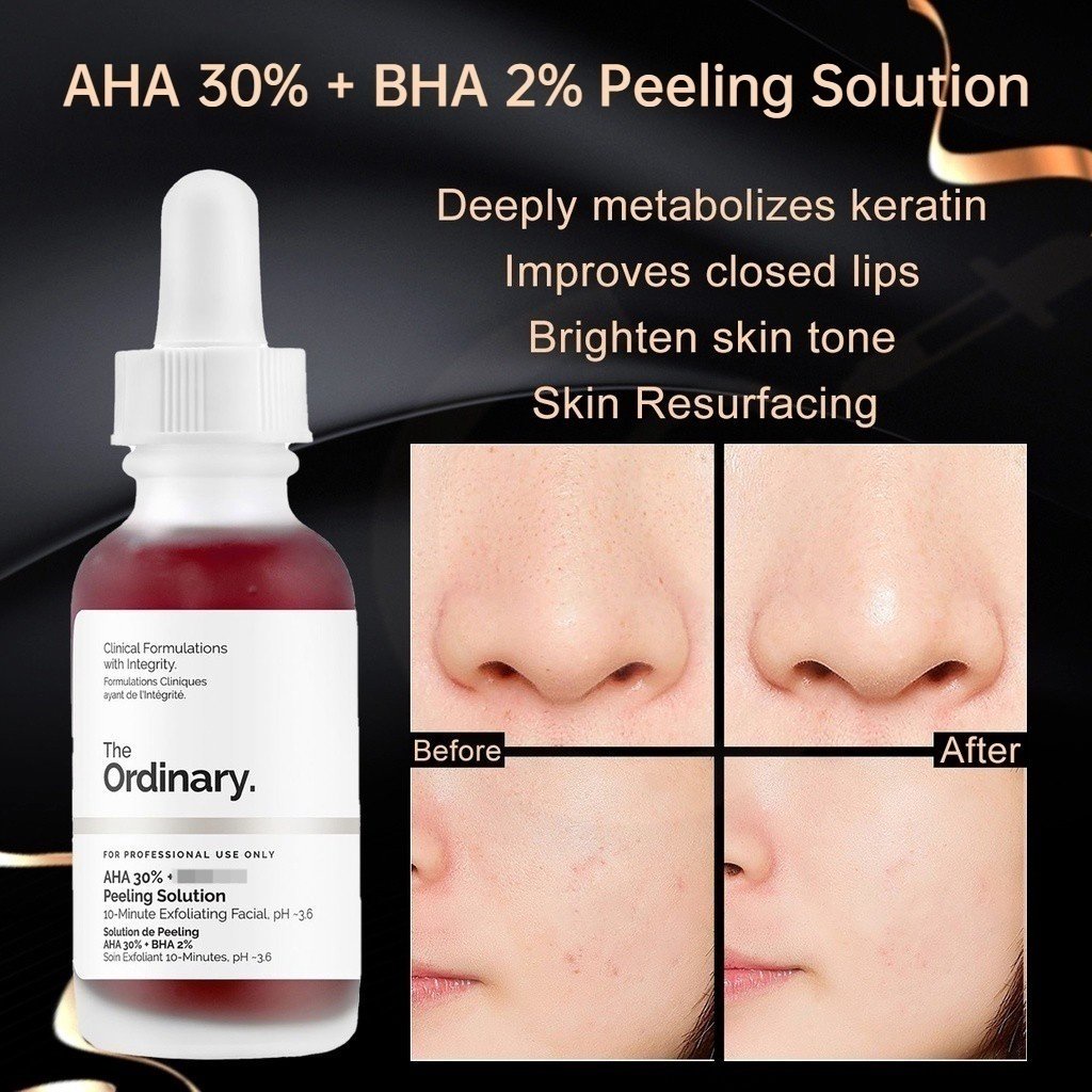 Original Ready Stock The Ordinary 30% AH-A + B-HA 2%