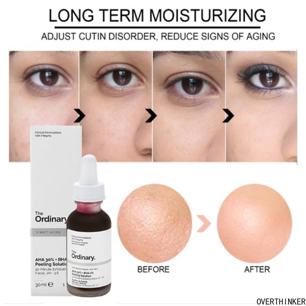 Original Ready Stock The Ordinary 30% AH-A + B-HA 2%