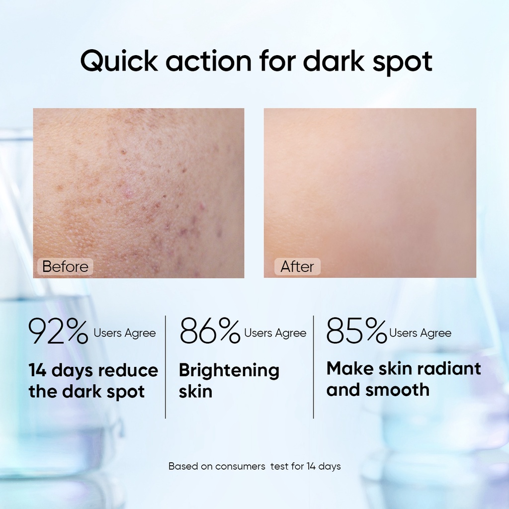 SKINTIFIC SymWhite 377 Dark Spot Serum With Niacinamide Brightening Serum Whitening Glowing Moisturi