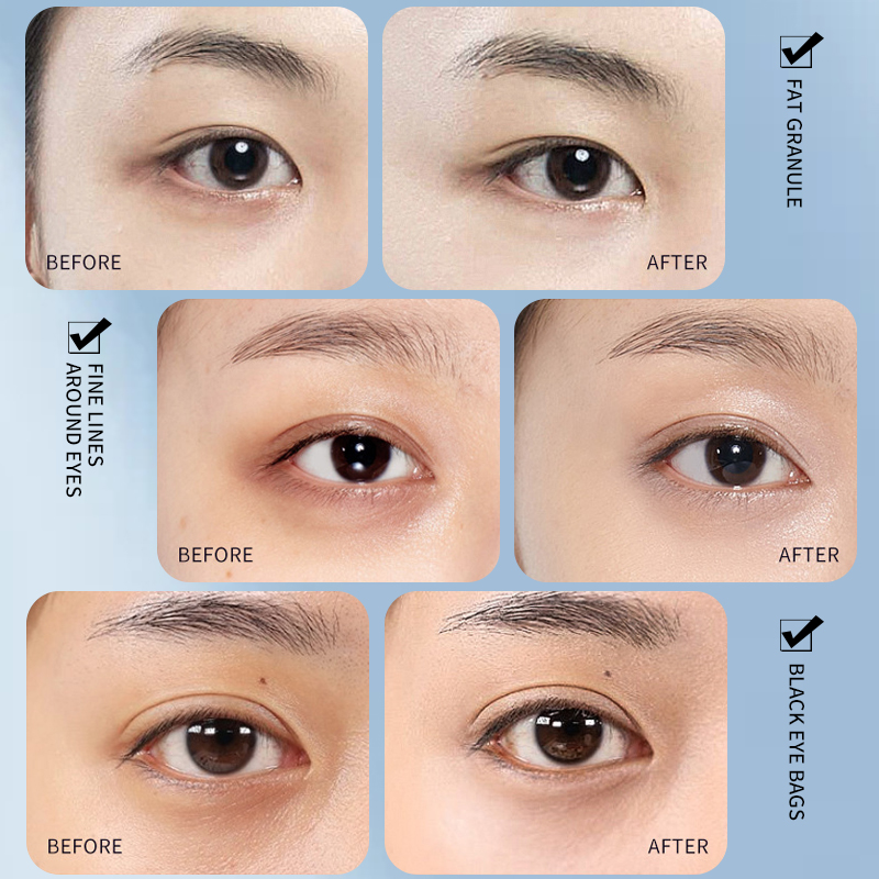 Hot Sale Eye Care Products Gentle And Soothing Fad