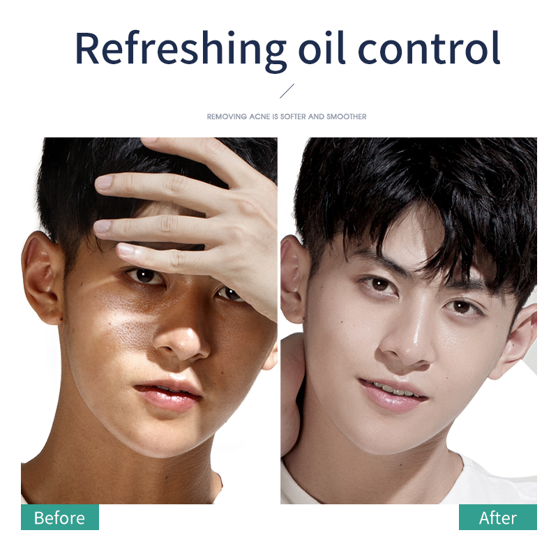 Deep Cleansing Day And Night Customised Niacinamid