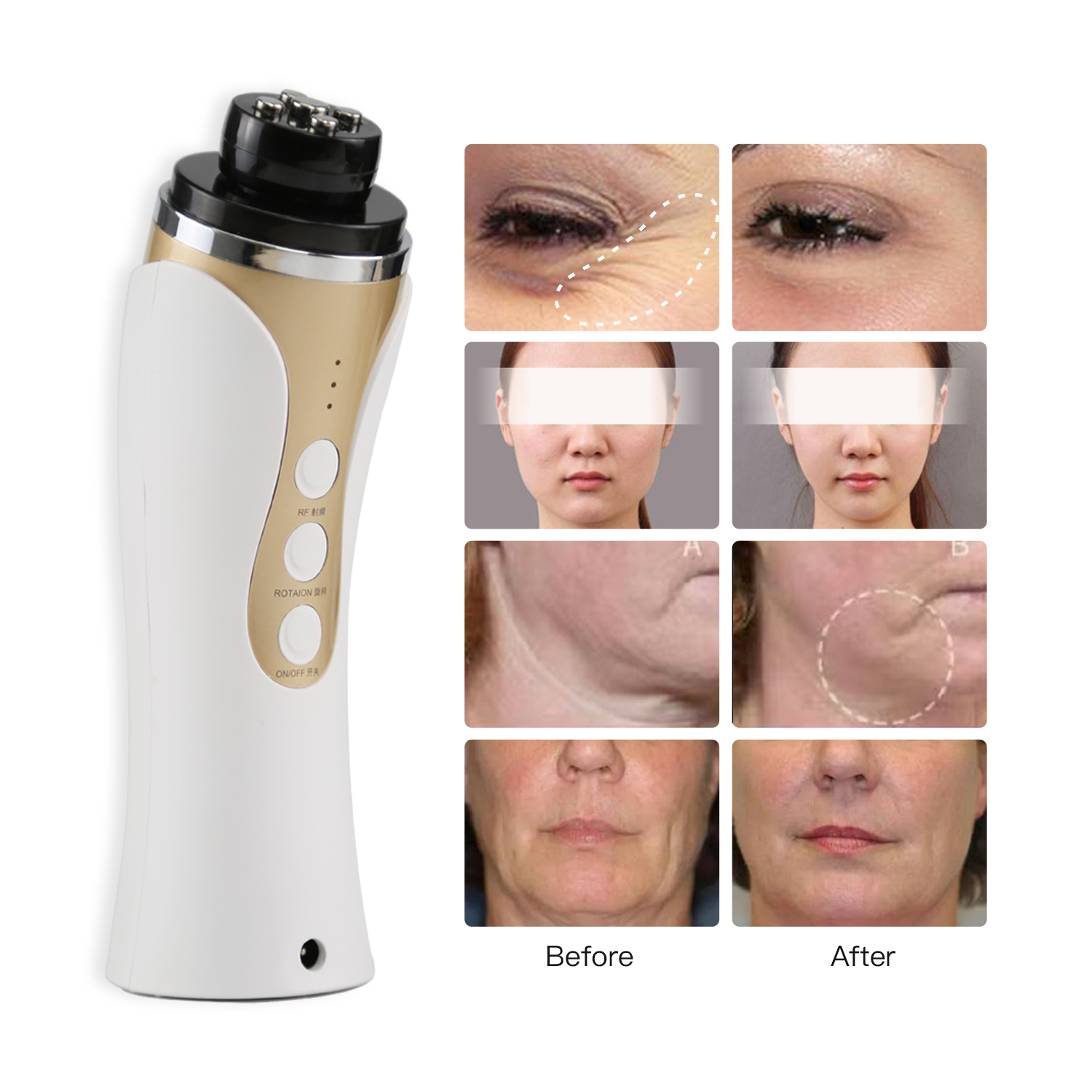 Customized High Quality Skin Rejuvenation Cosmetol