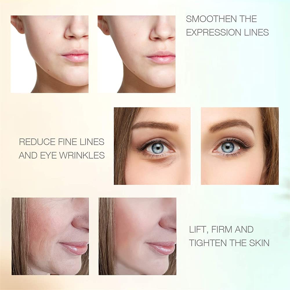 Face Massager RF Facial Beauty Machine Radio Frequency Facial Skin Tightening Professional Home RF L